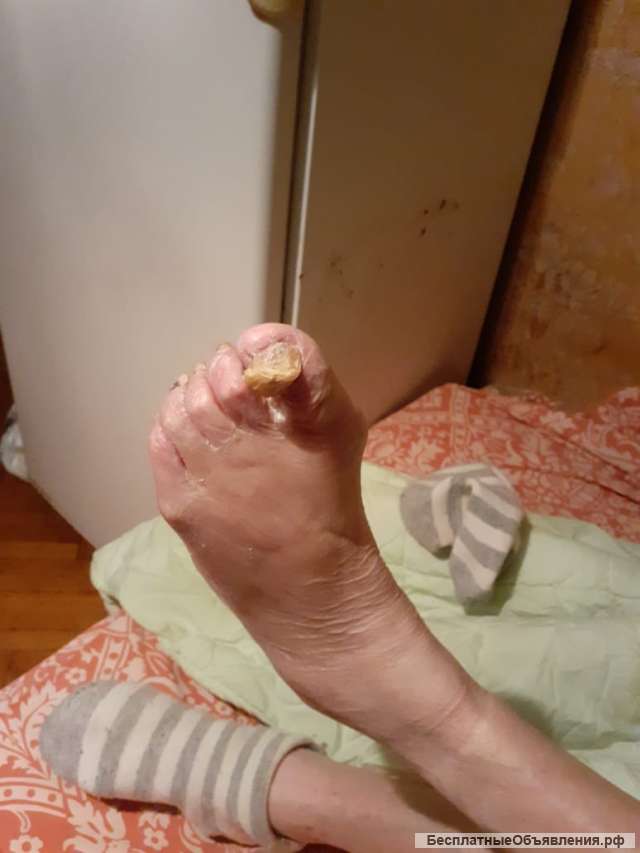 Фото Ног Пожилых Людей